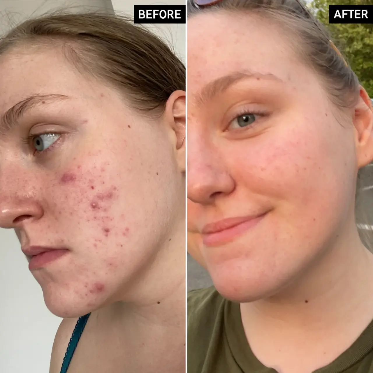 5 Best Glycolic Acid Toners for Gentle Resurfacing article image