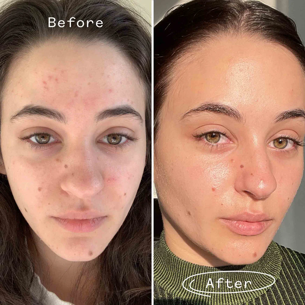 5 Best Nighttime Oil-Control Products for Balanced Skin article image