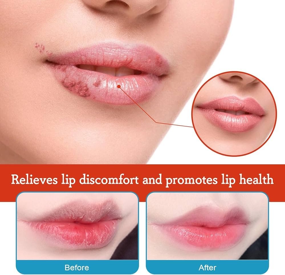 5 Best Lip Treatments for Severely Chapped Lips (2026) article image