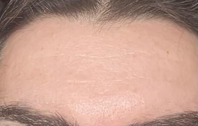 Second supplied close-up forehead image associated with Olay Regenerist cream