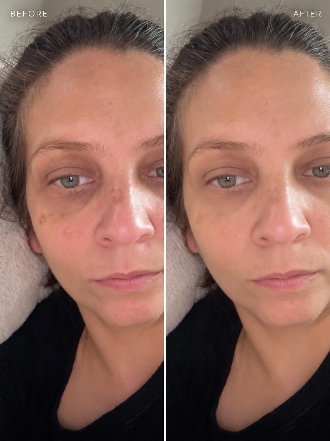 Supplied before-and-after image associated with La Roche-Posay tinted mineral sunscreen