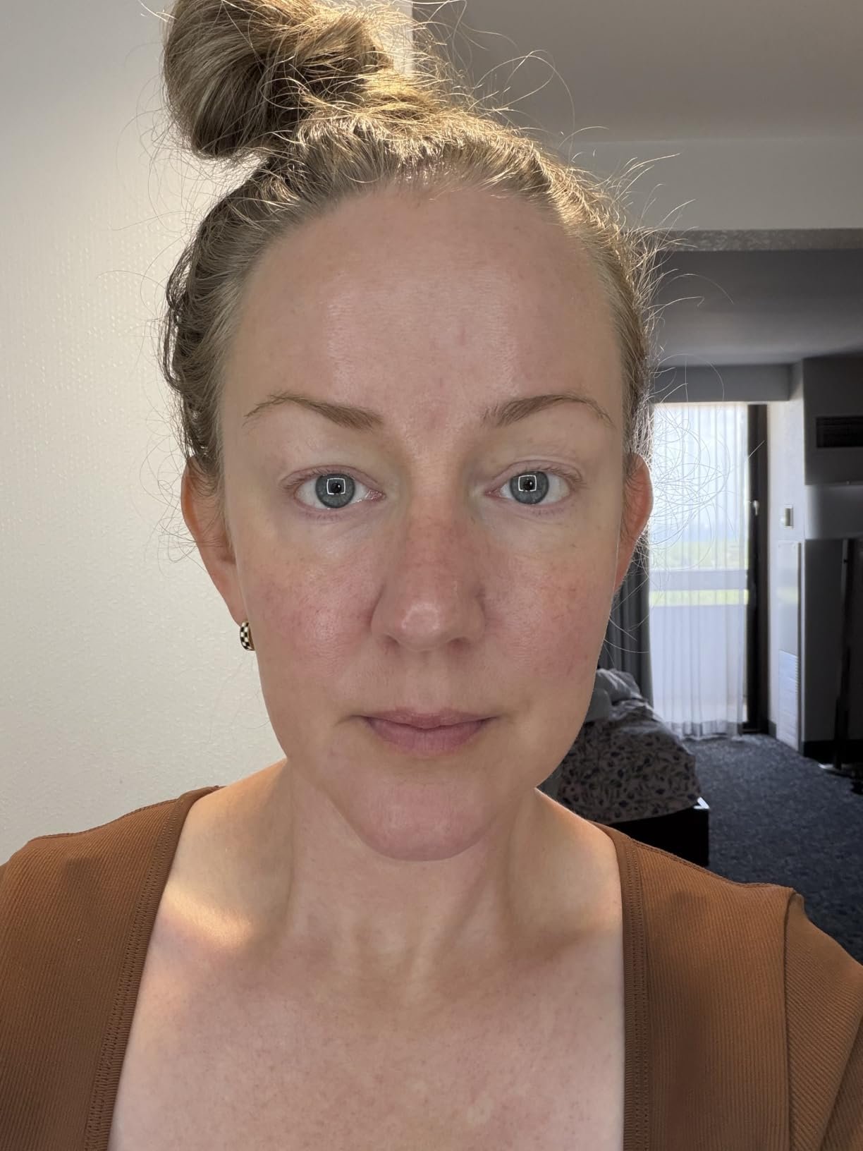 Supplied facial routine photo associated with Skinfix Barrier Plus cream