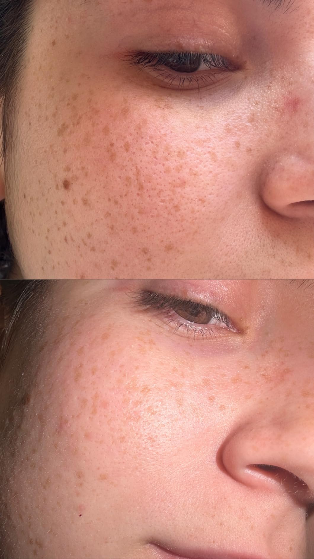 Customer-submitted side-by-side close-up of facial skin texture