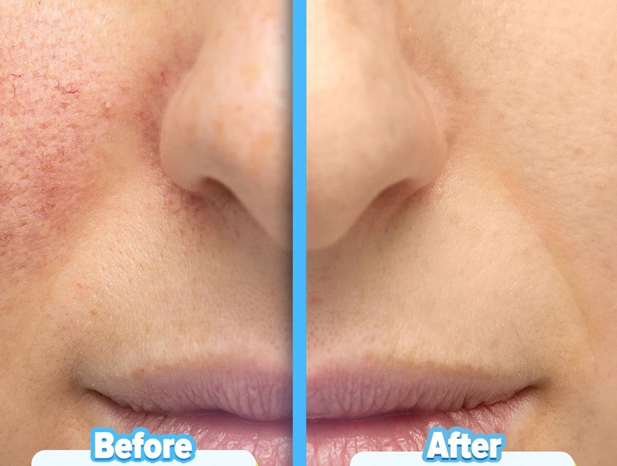 7 Best Ceramide Creams and Serums for Dry Skin article image