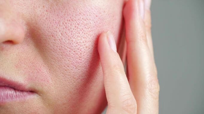 6 Best Lightweight Hydrating Serums for Oily Skin article image