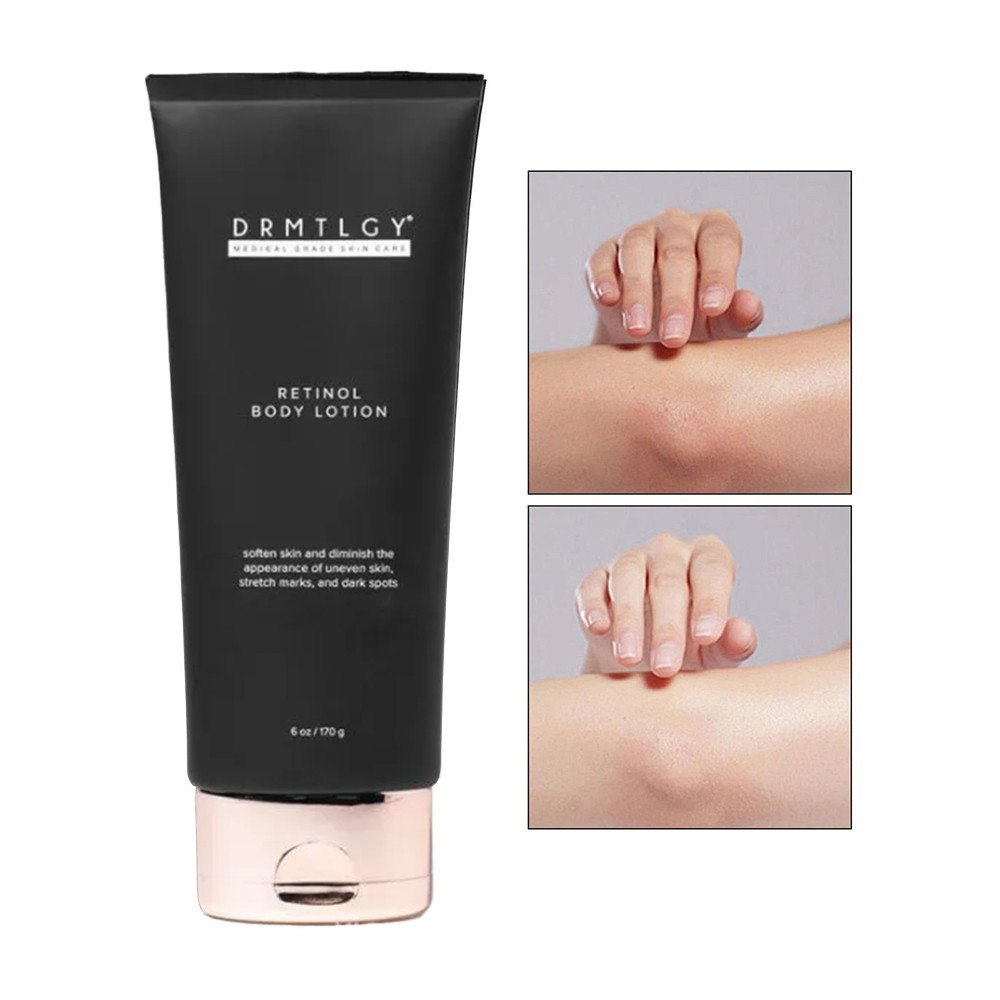 DRMTLGY Retinol Body Lotion tube beside two arm close-ups