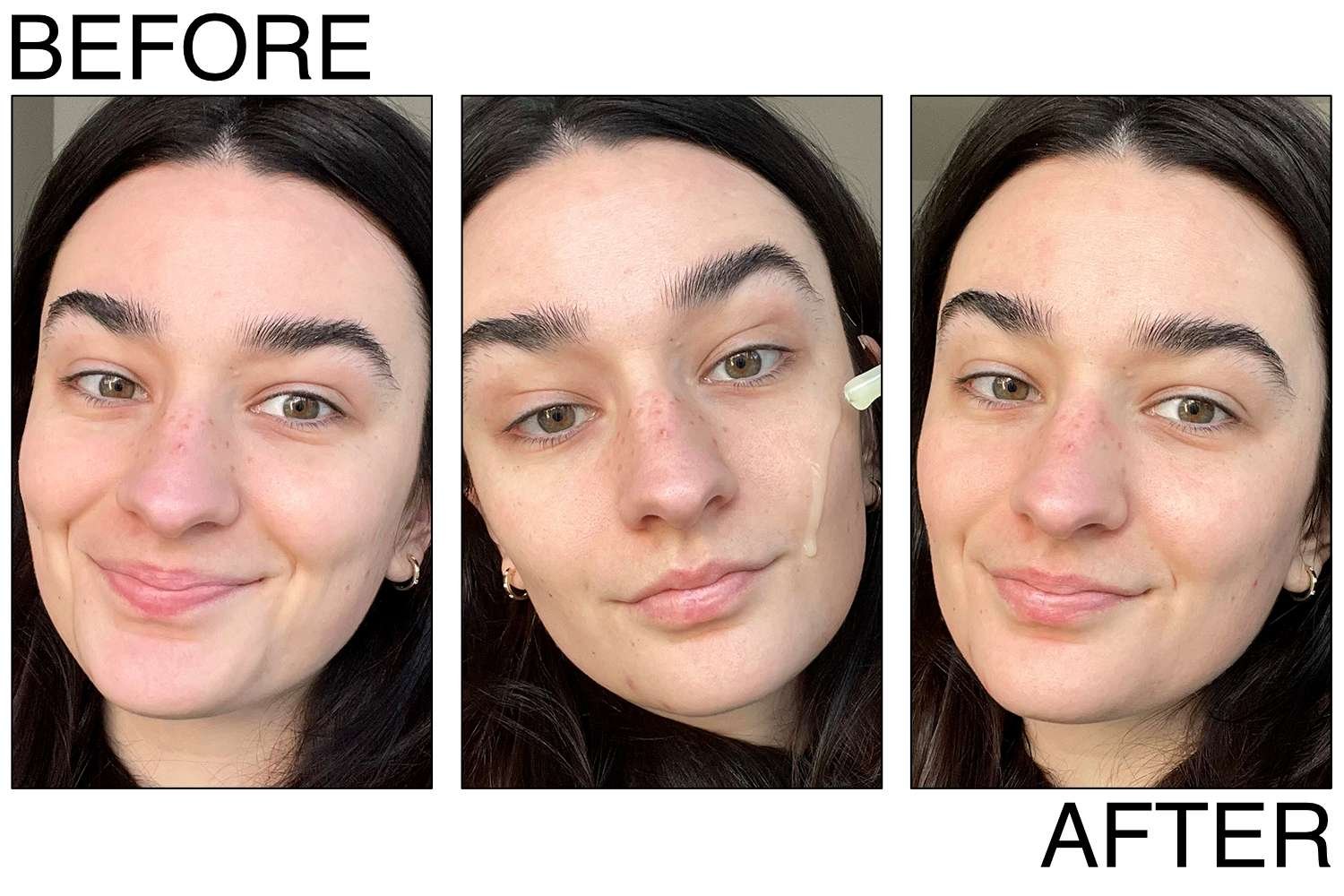 User-supplied before, application, and after comparison associated with La Roche-Posay Retinol B3 serum