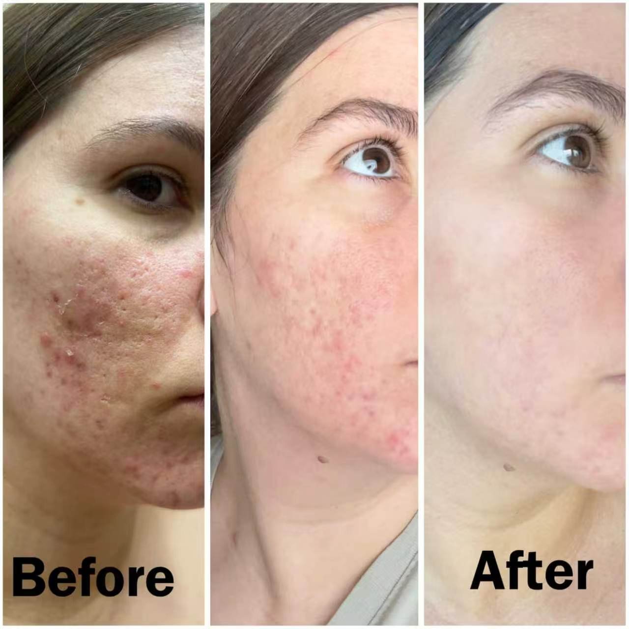 User-supplied three-panel facial skin comparison associated with medicube Booster Pro