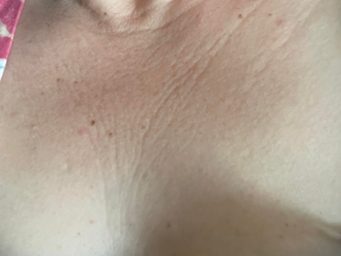 Close-up of neck and chest skin paired with the Medix 5.5 body cream