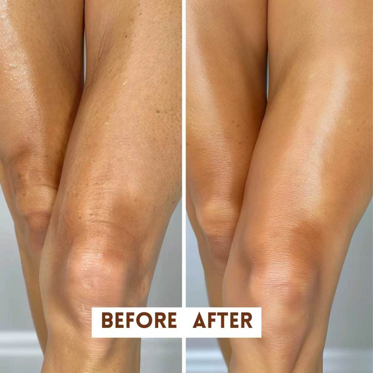 User-submitted before-and-after leg collage paired with Rosen Apothecary Retinol Body Lotion