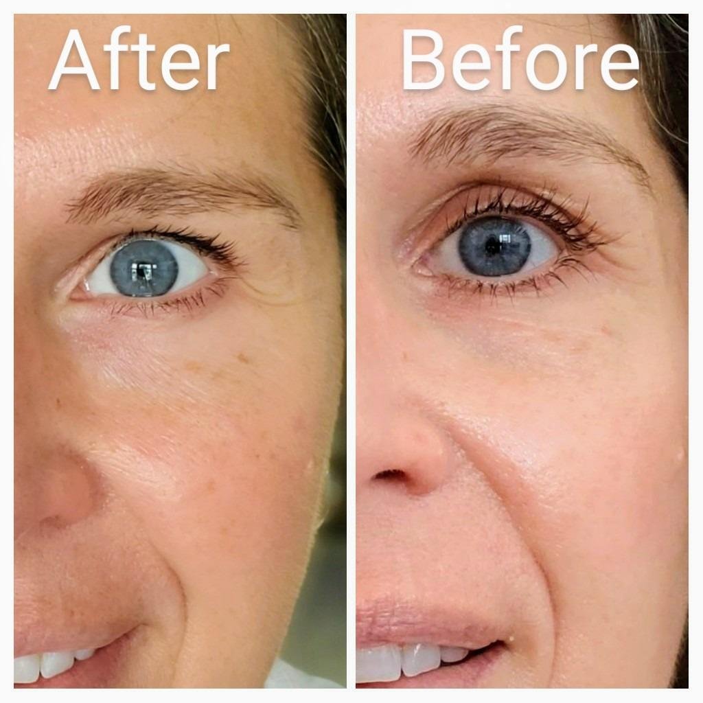 Best anti-aging serums for women over 40 that reduce wrinkles and improve skin texture