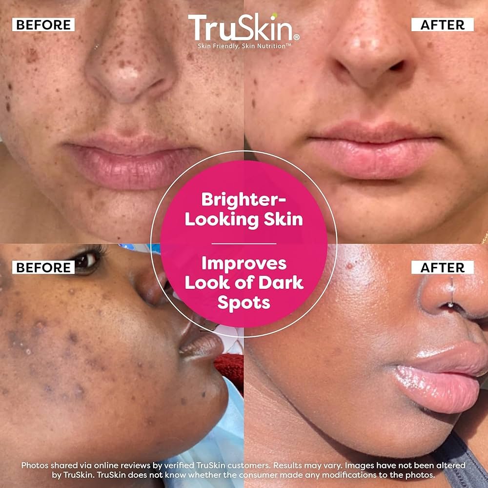 8188TMoH5L. UF10001000 QL80