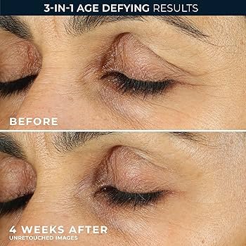 Best Affordable Eye Cream for Dark Circles: Top Picks Under $50 9 best affordable eye cream