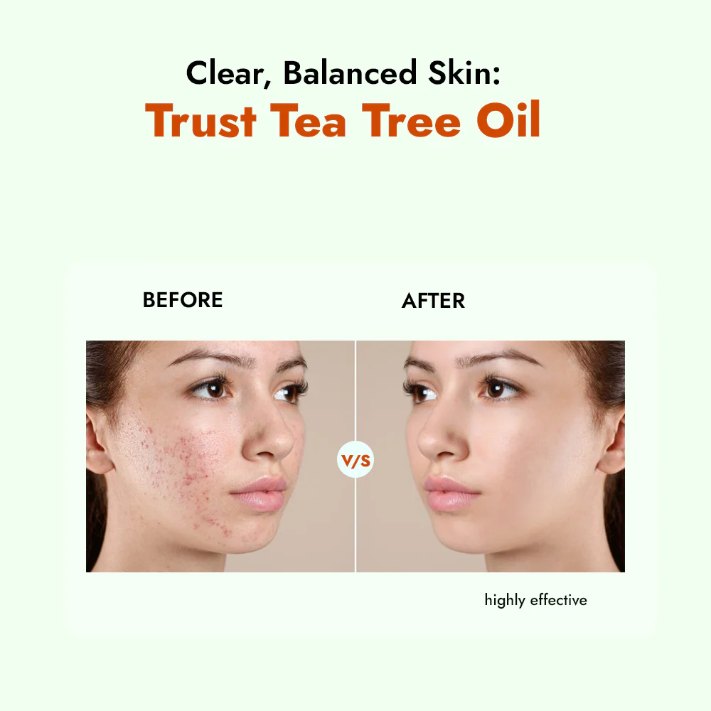 Best Natural Tea Tree Oils for Blackheads 2025