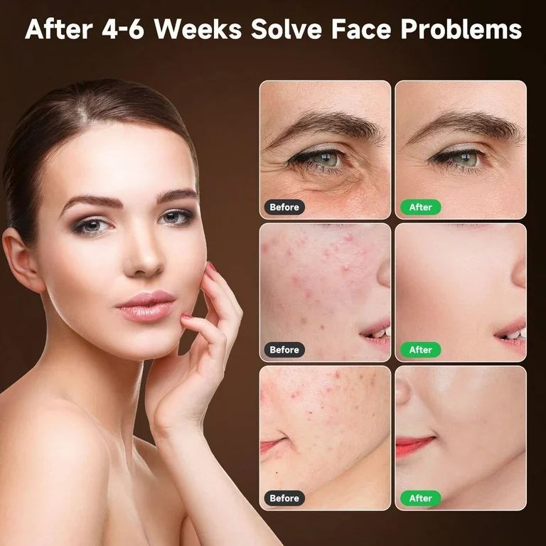 best Red Light Therapy LED Face Masks 2025