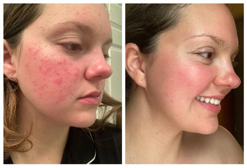 36611cac dd6a 42c4 beec 1cb2b675da7e 56045