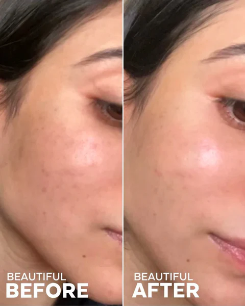 Best Microbiome-Friendly Cleansers for Face 2025