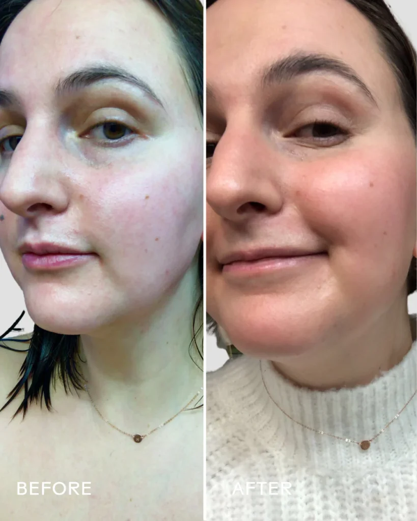 Best Retinol Alternatives for Beginners in 2025 | Gentle Anti-Aging Skincare Without the Irritation 11 5 00ca1e98 0eba 48b2 a6a5 8785f44fd570 2048x2048