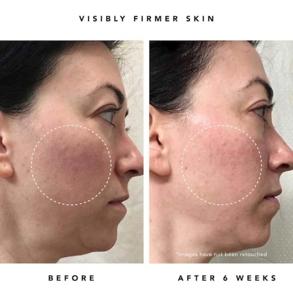 Best Retinol Alternatives for Beginners in 2025 | Gentle Anti-Aging Skincare Without the Irritation 3 Best Retinol Alternatives for Beginners in 2025