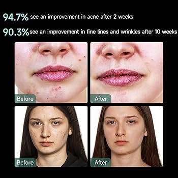 best Red Light Therapy LED Face Masks 2025