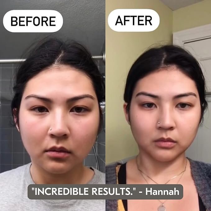 Best Affordable Gua Sha Tools 2025