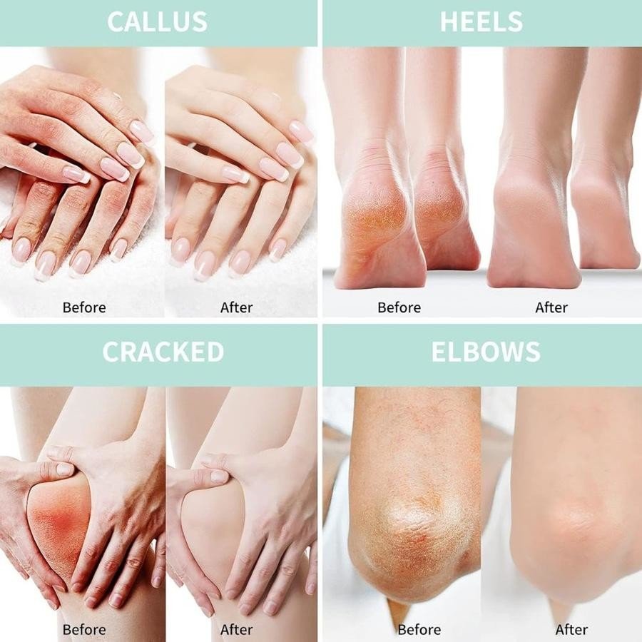 Best Organic Foot Creams for Calluses 2025