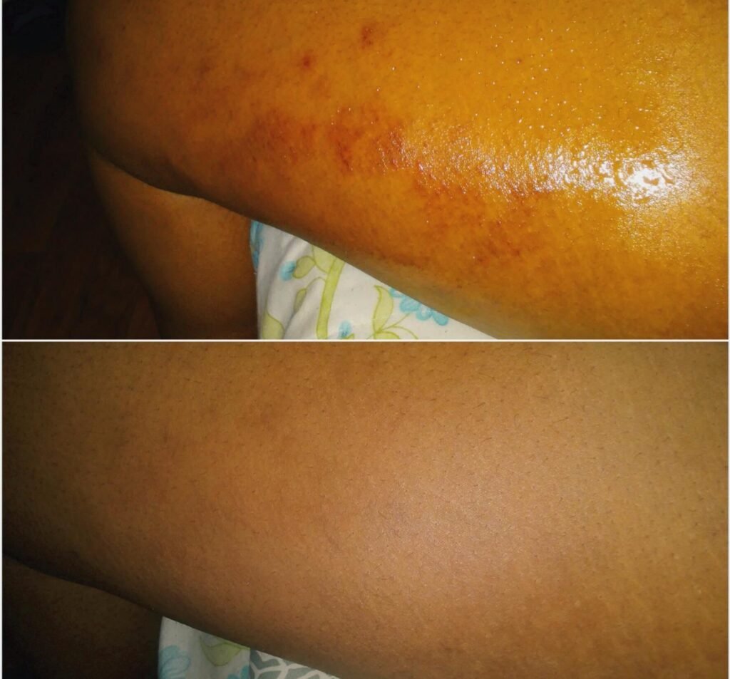 Best Organic Body Lotions for Eczema