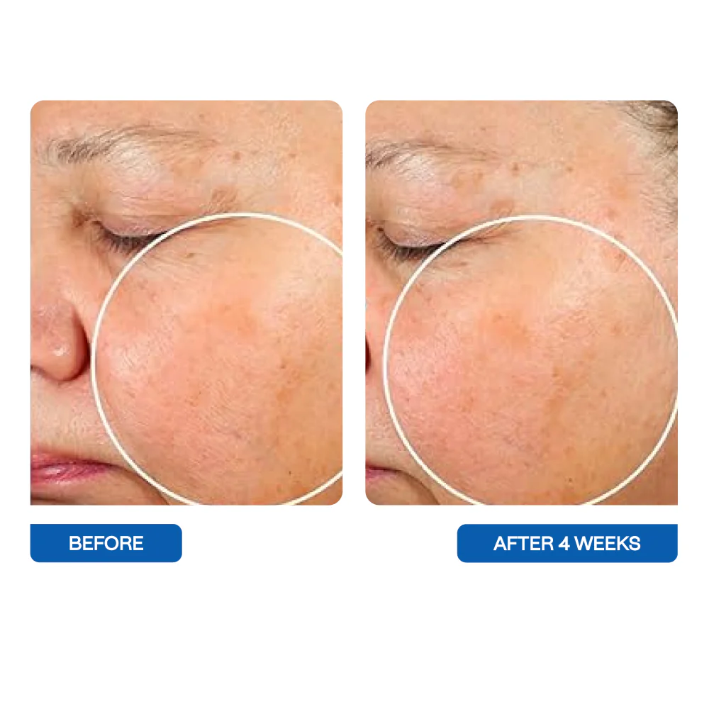 Best Microbiome-Friendly Cleansers for Face 2025