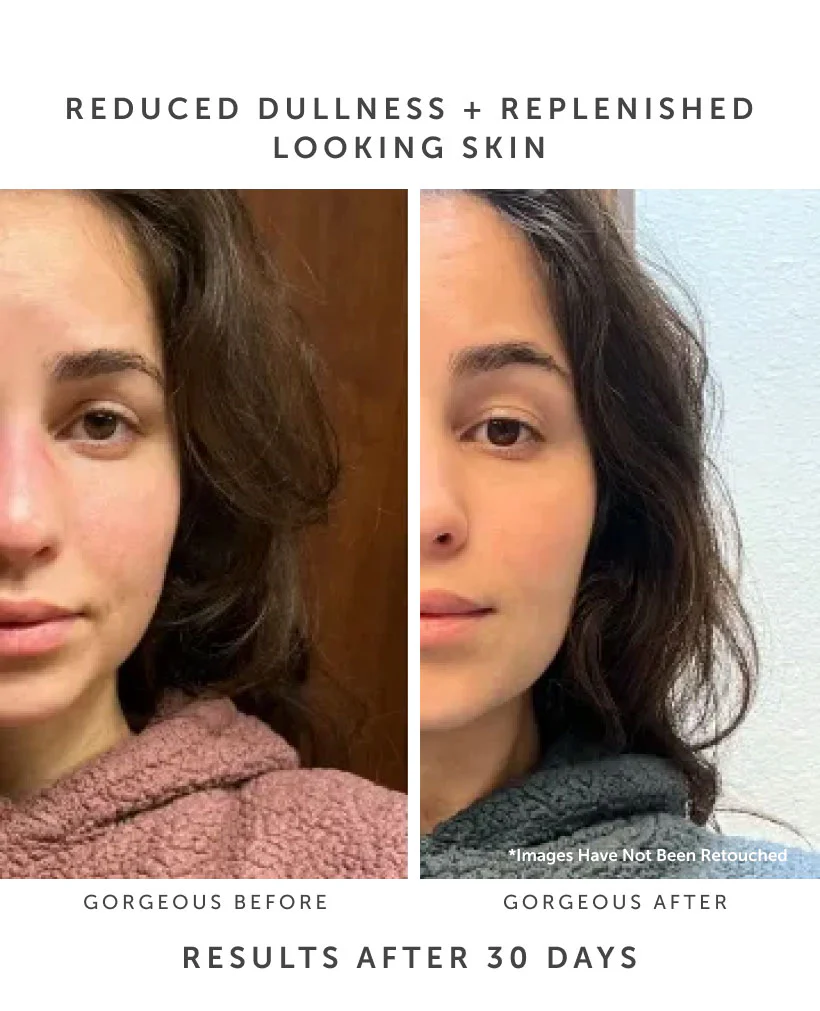 Affordable Organic Skincare for Beginners in 2025 | Budget-Friendly & Clean Picks 9