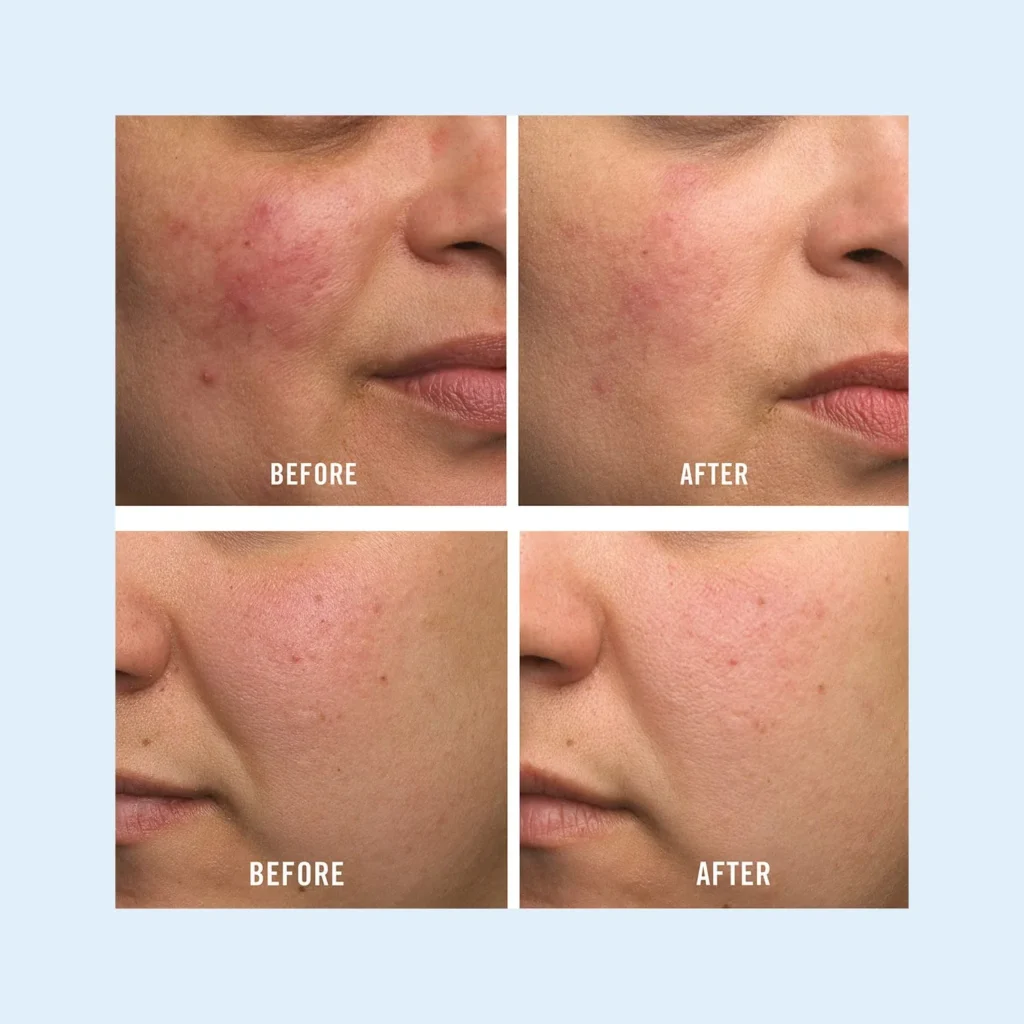 Best Winter Moisturizers for Dry Skin 2025