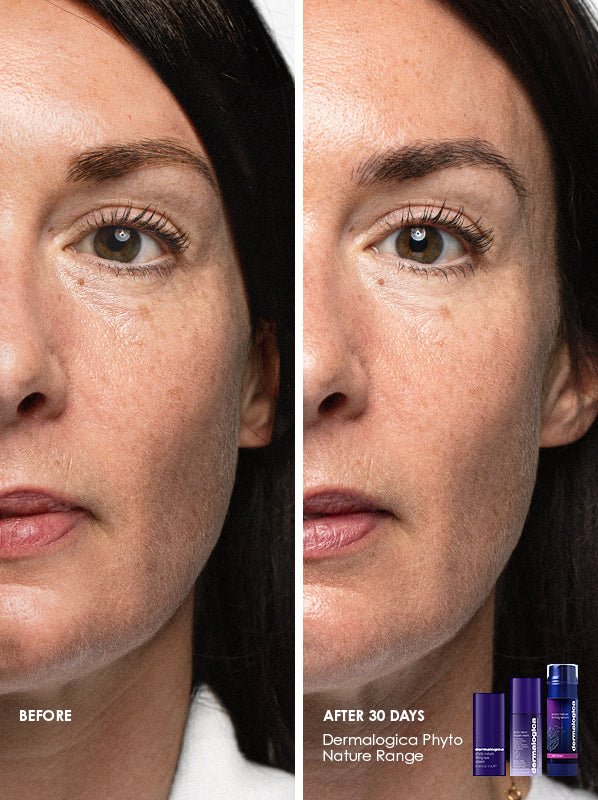 FullFace BeforeAfter Alicia 1