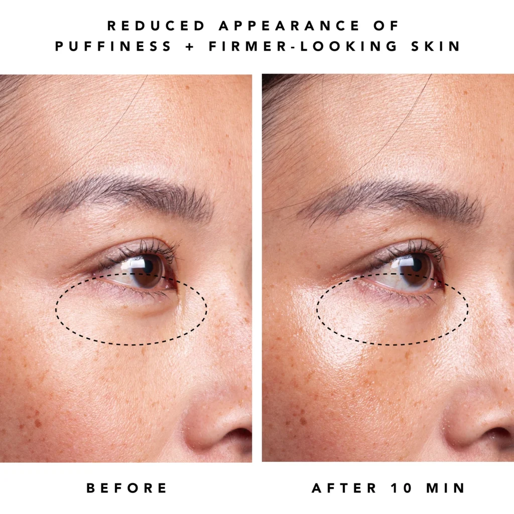 Best Affordable Bakuchiol Serums