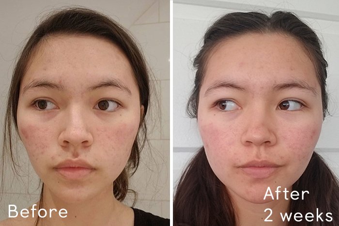 Best Affordable Bakuchiol Serums