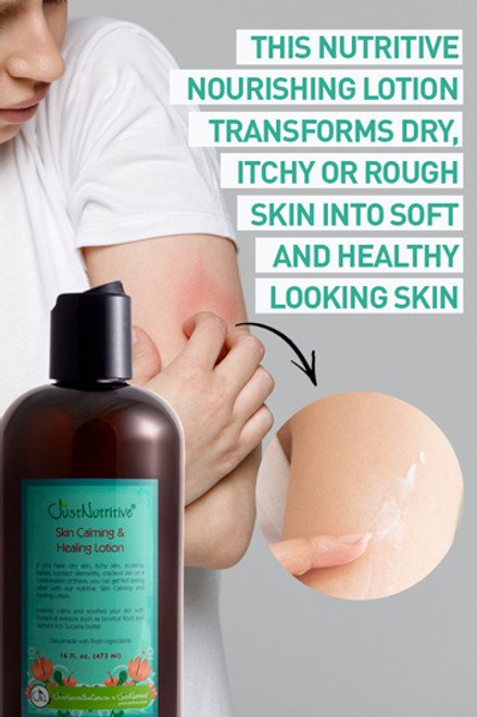 Best Organic Body Lotions for Eczema