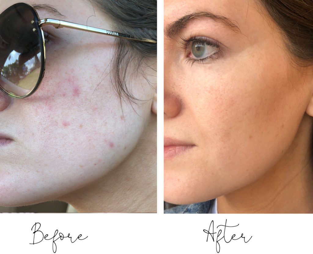 affordable peptide creams for wrinkles 2025