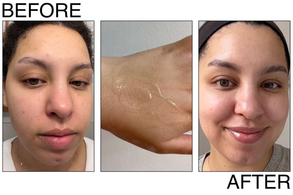 Best Affordable Bakuchiol Serums