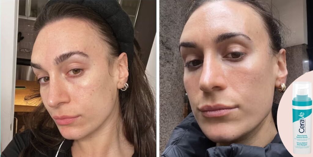 cerave retinol serum review 68135960c523f