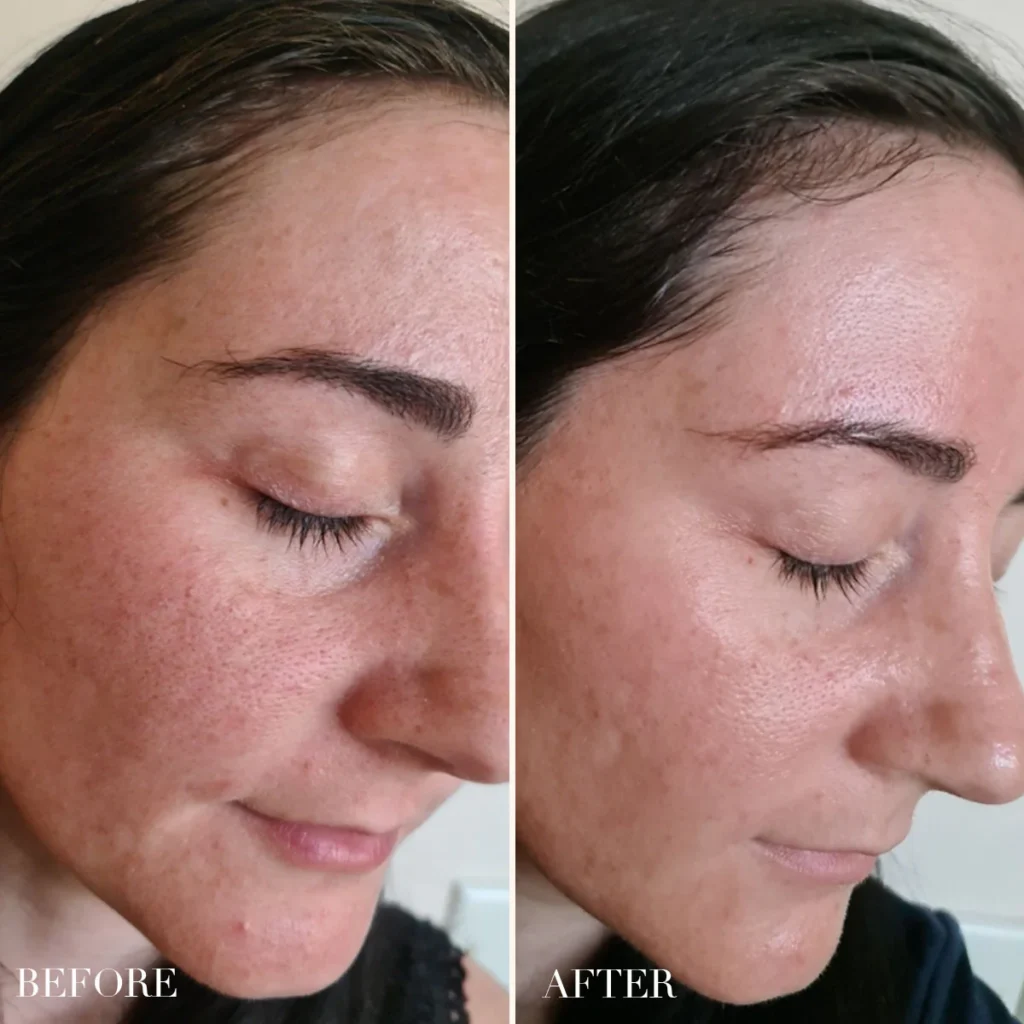 Best Retinol Alternatives for Beginners in 2025 | Gentle Anti-Aging Skincare Without the Irritation 7 Best Retinol Alternatives for Beginners in 2025