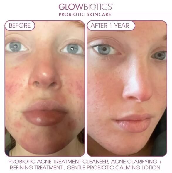 Best Microbiome-Friendly Cleansers for Face 2025