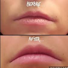 lip scrub for smokers