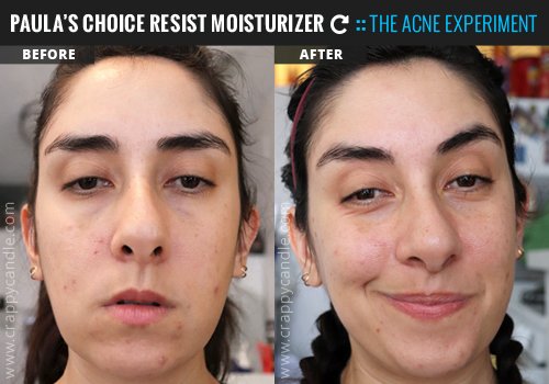 Best Ceramide Lotions for Barrier Repair