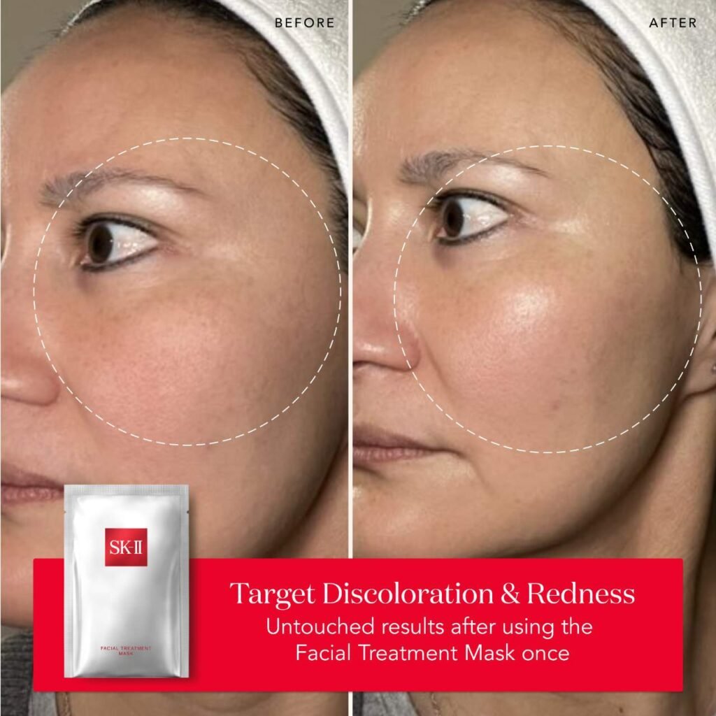 Best Hydrating Masks for Dehydrated Skin in 2025