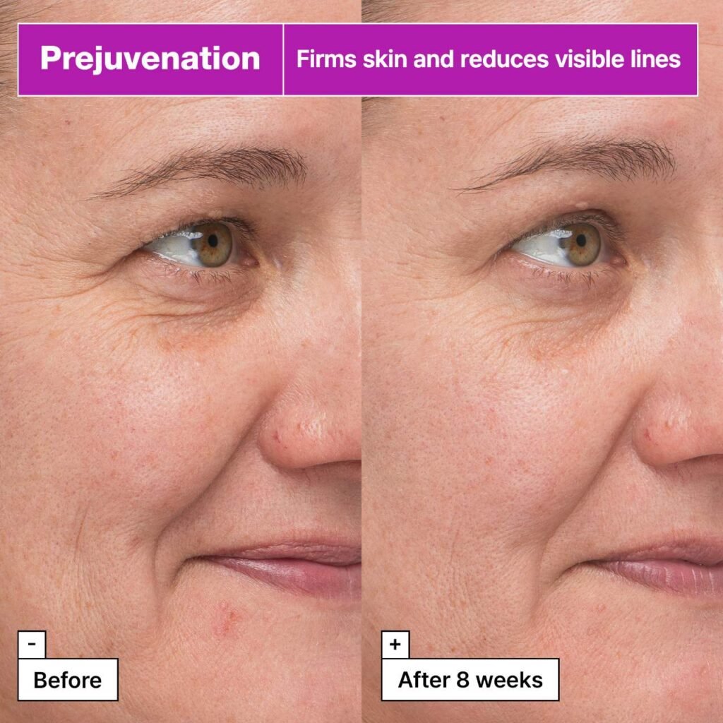 Best Retinol Alternatives for Beginners in 2025 | Gentle Anti-Aging Skincare Without the Irritation 9 s2790269 av 3 zoom