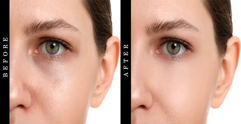 universal tinted moisturizer spf 46 Before After