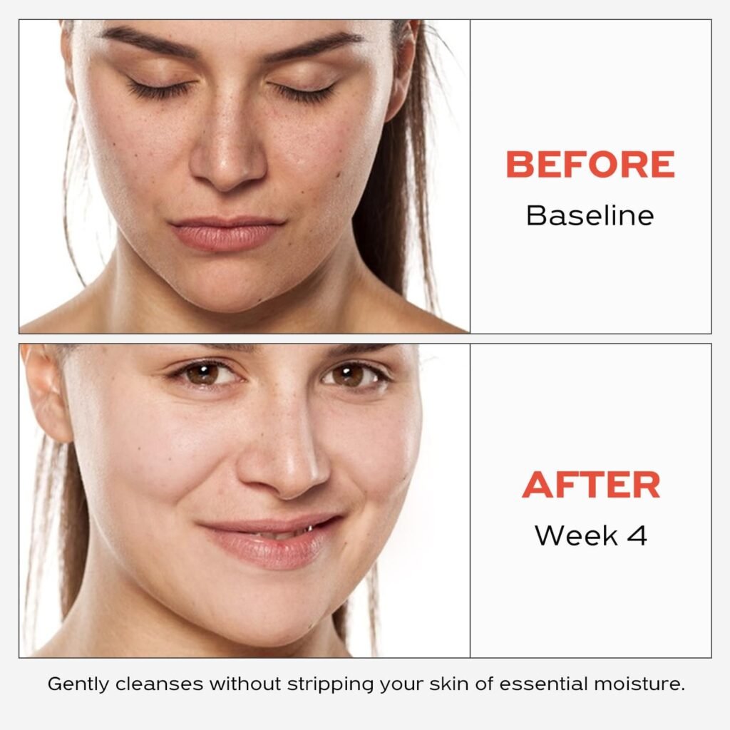 Best Cleansers for Removing Waterproof Sunscreen 2025