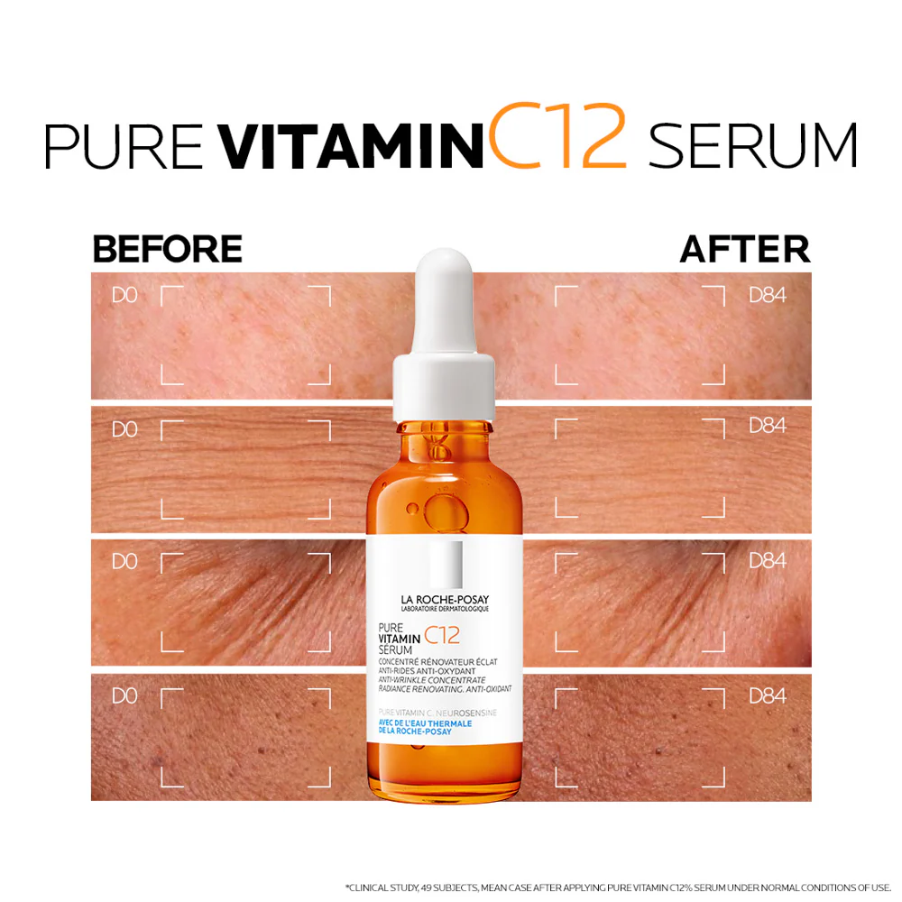 Best Antioxidant Serums for Pollution-Exposed Skin 2025