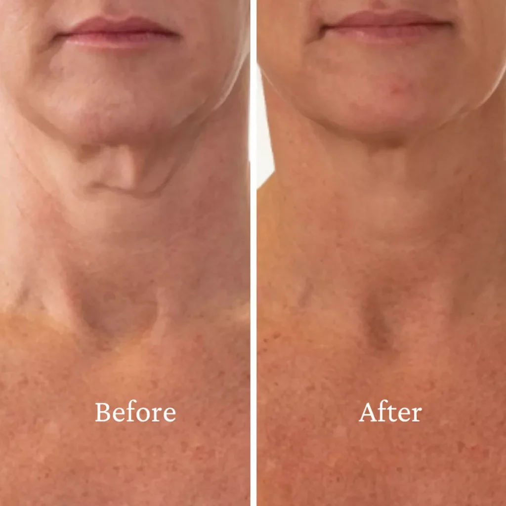 Best Collagen-Boosting Creams for Décolletage and Chest 2025