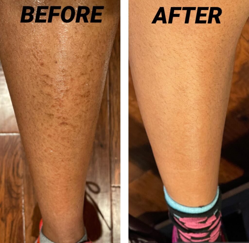 Lactic Acid Body Lotion 2025