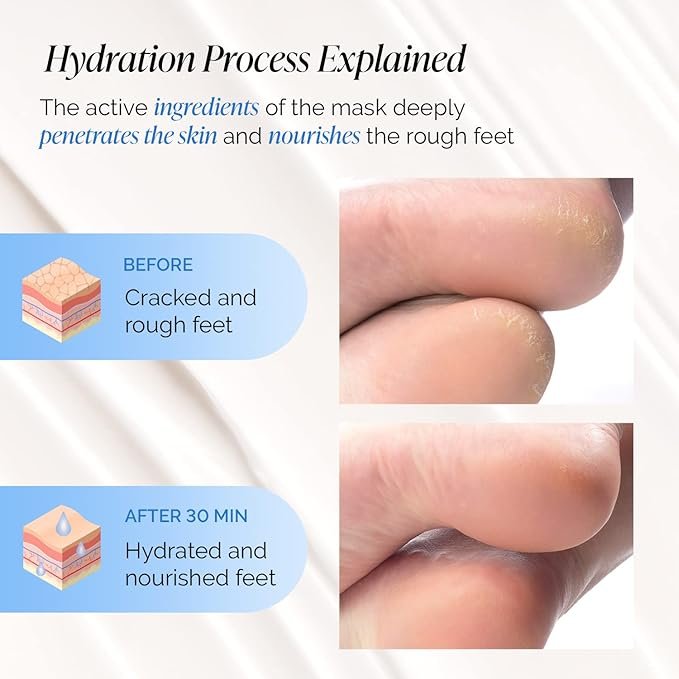 Best Vegan Foot Masks for Dry, Cracked Heels 2025 | Soften & Repair Naturally 3 Best Vegan Foot Masks for Dry