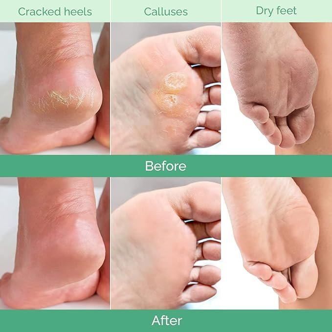 Best Vegan Foot Masks for Dry, Cracked Heels 2025 | Soften & Repair Naturally 7 Best Vegan Foot Masks for Dry